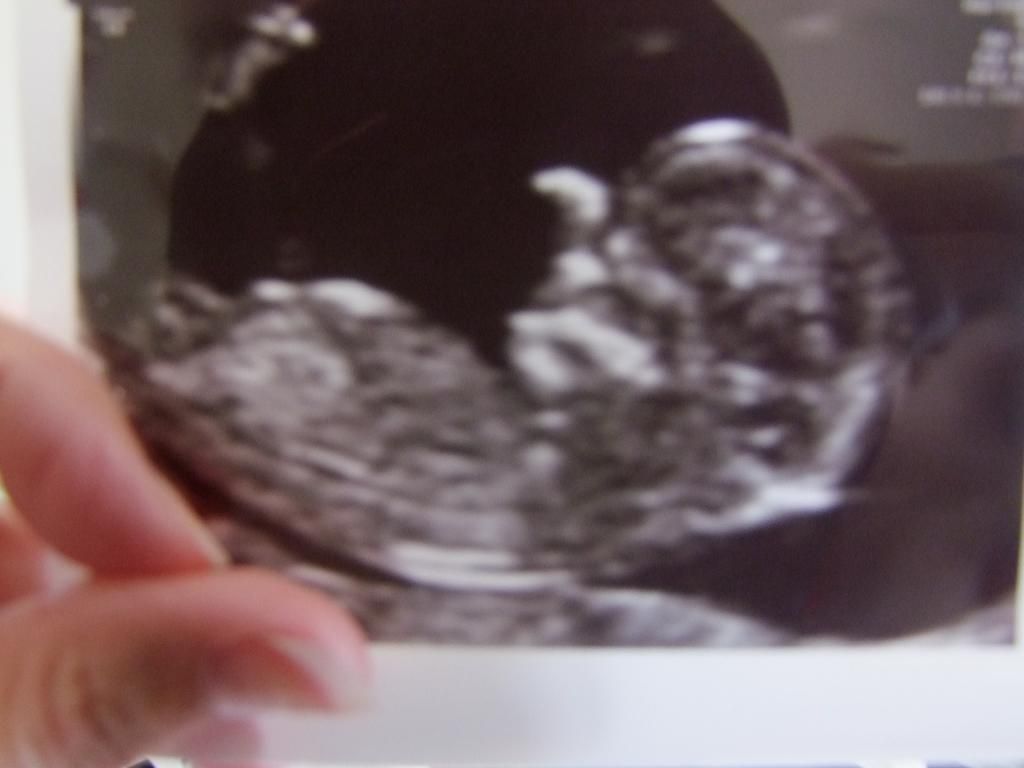 Can i still get pregnant on my non fertile days, getting pregnant iud